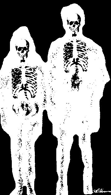 OBL as 2 skeletons